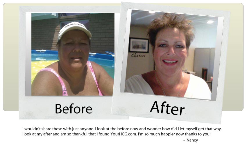 hcg diet weight loss photo hcg diet weight loss